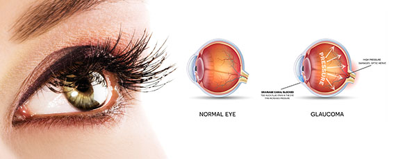 Eye Clinic in Vaishali Nagar Jaipur